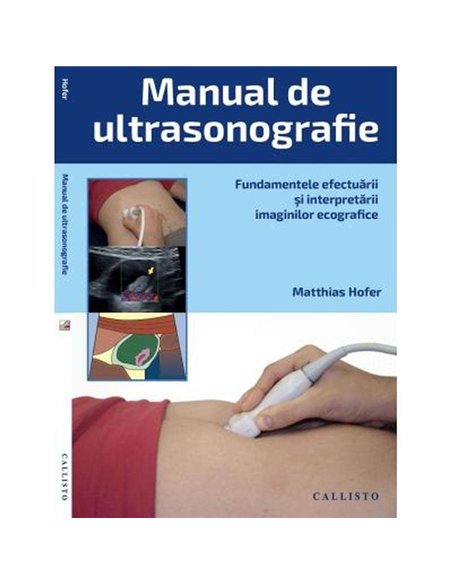 Manual de ultrasonografie. Fundamentele - Matthias Hofer | Callisto